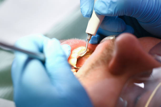 Best Broken Tooth Emergency  in Greenville, MS
