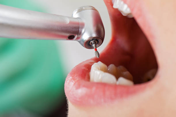 Emergency Dentist Open Today in MS